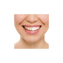 DISPOSITIVO PROFESSIONALE SBIANCANTE A LED DENTI DENTAL WHITE RX SORRISO SUPER