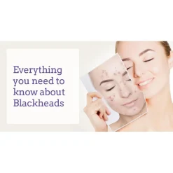 DISPOSITIVO RICARICABILE PER PULIZIA VISO PORI MACCHIE SCURE PUNTI NERI Q-M300