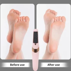 PEDICURE A BATTERIA RICARICABILE ELIMINA CALLI RIMUOVI DURONI PIEDI ESFOLIANTE